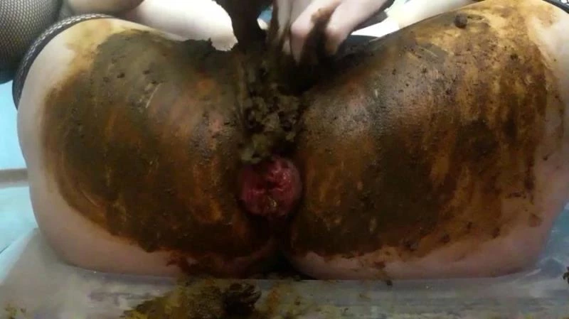 Anal Prolapse In Shit - Toilet - FullHD (2024)